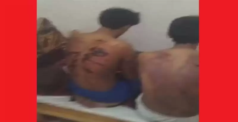 غضب واسع بعد تعرض شباب يمنيين لتعذيب بشع من قبل الجيش العُماني...  صورة وتفاصيل